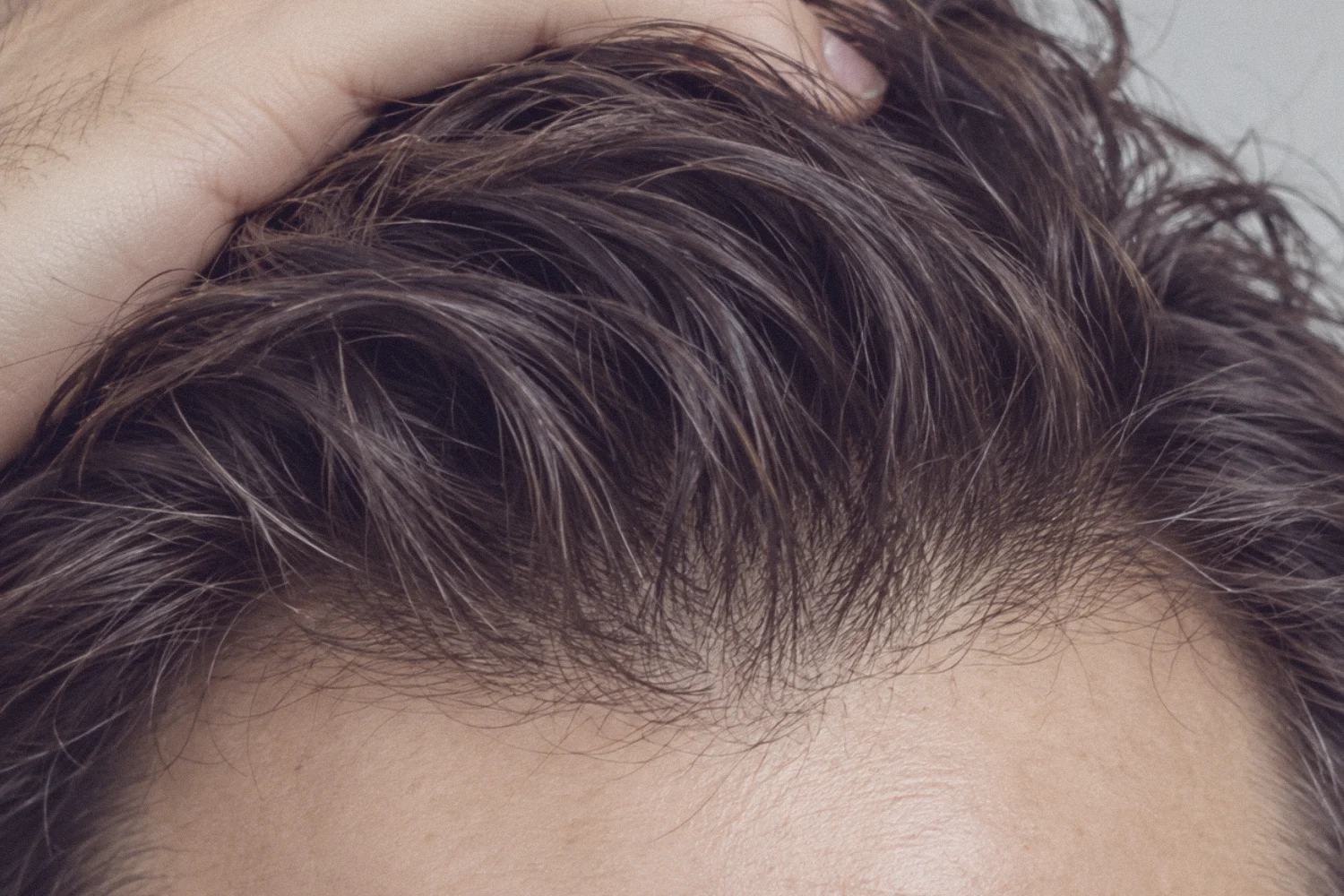 A man running his hand back through a full head of hair