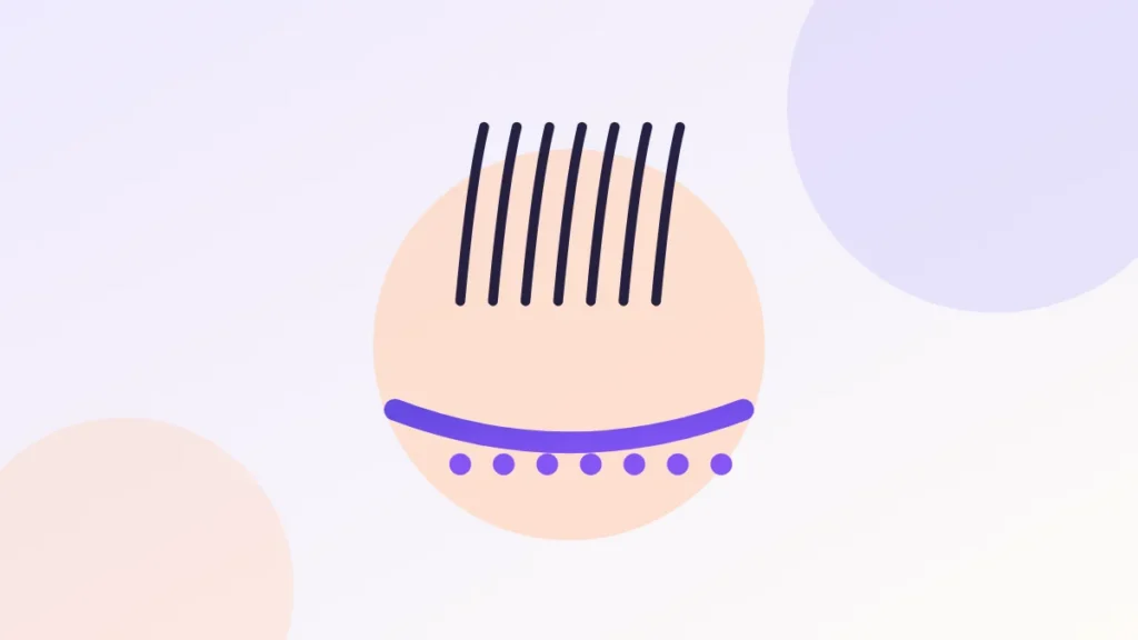Illustration of donor and recipient areas on a scalp with follicular unit detail