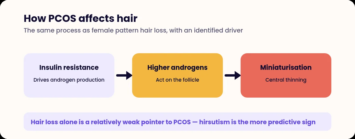 Diagram of the pathway from insulin resistance to hair thinning in PCOS